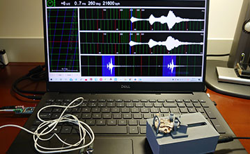 浪琴手表消磁(免费) 浪琴手表消磁(免费)